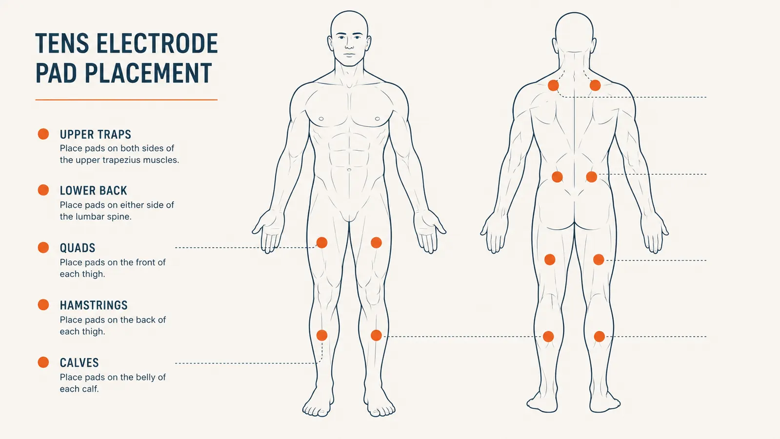 Diagram showing correct TENS pad placement positions for quads, hamstrings, and lower back